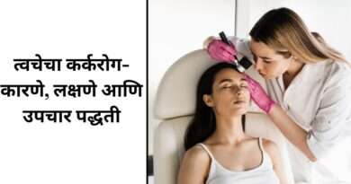 त्वचेचा कर्करोग उपचार