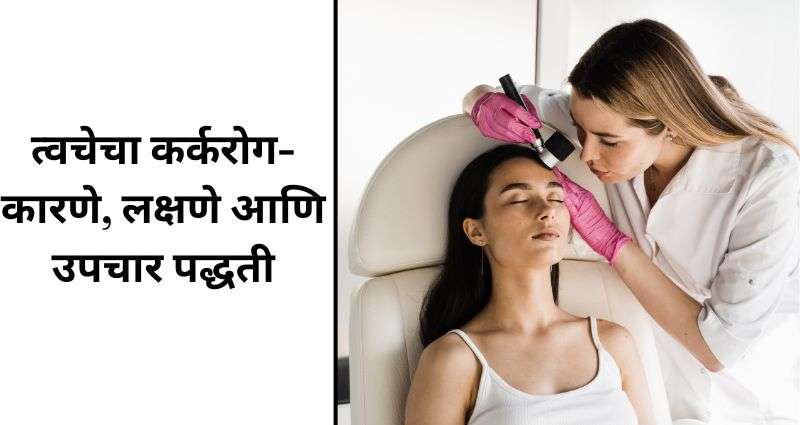 त्वचेचा कर्करोग उपचार